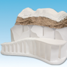 Understructure & Formation